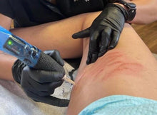 Load image into Gallery viewer, Scar &amp; Stretchmark Revision Hands-On Training Deposit
